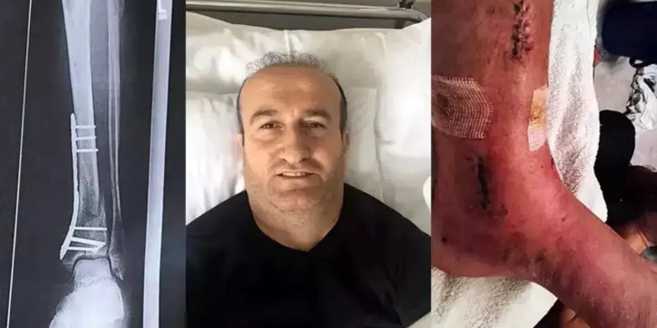 Antalya'da Çukur İhmaline 1,05 Milyon TL Tazminat