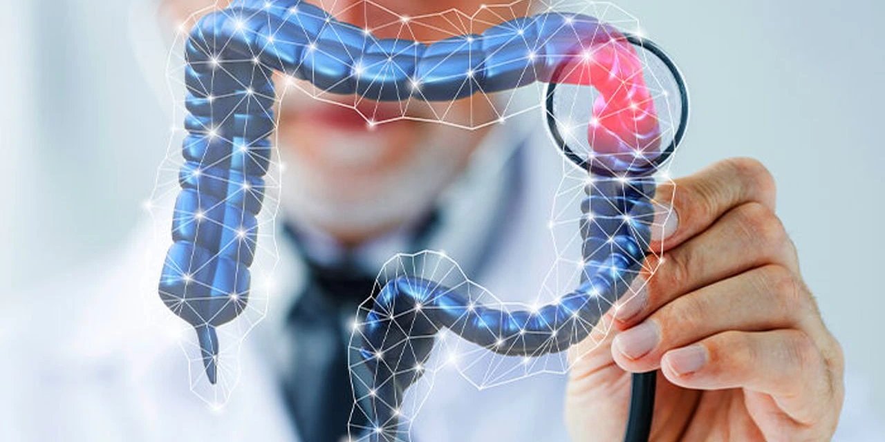 Kolorektal Kanserde Erken Tanı Hayat Kurtarıyor