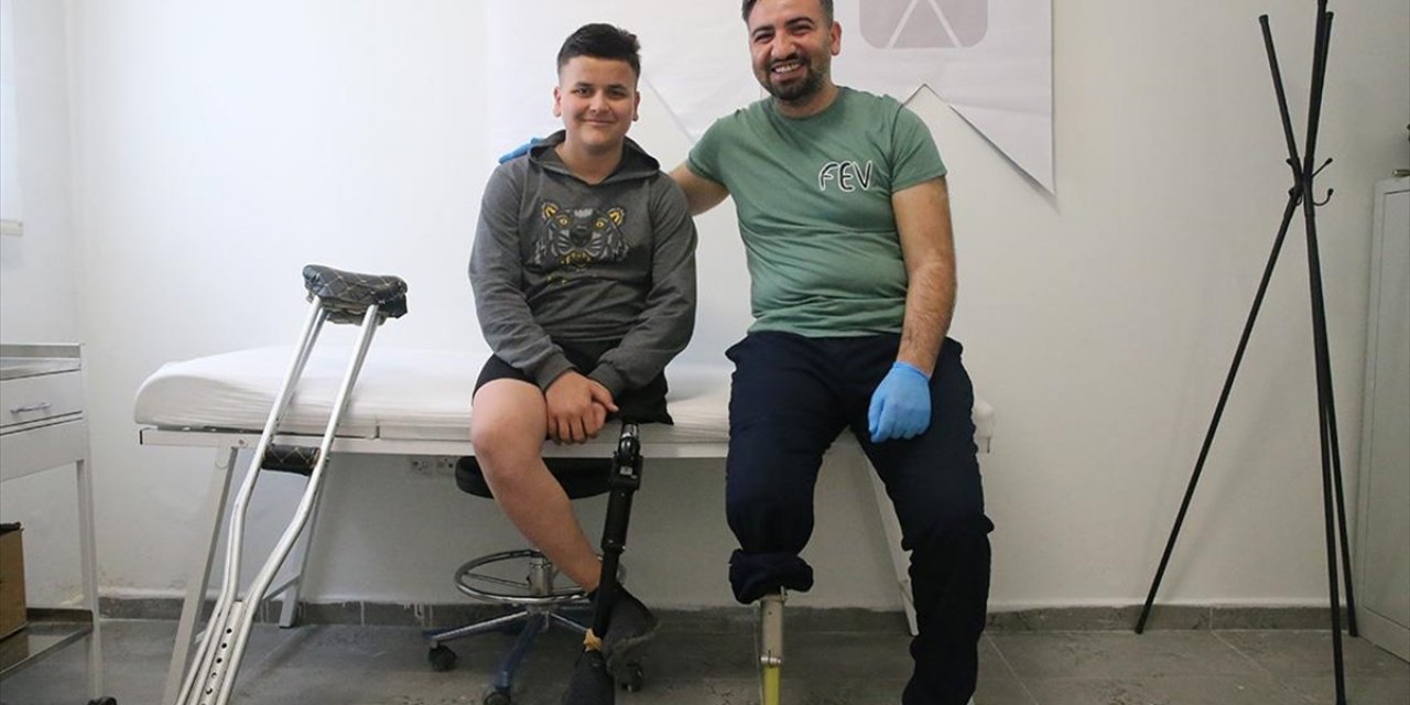 Ampute Protez Teknikeri Kendisi Gibi Uzuv Kaybı Yaşayanlara Umut Oluyor
