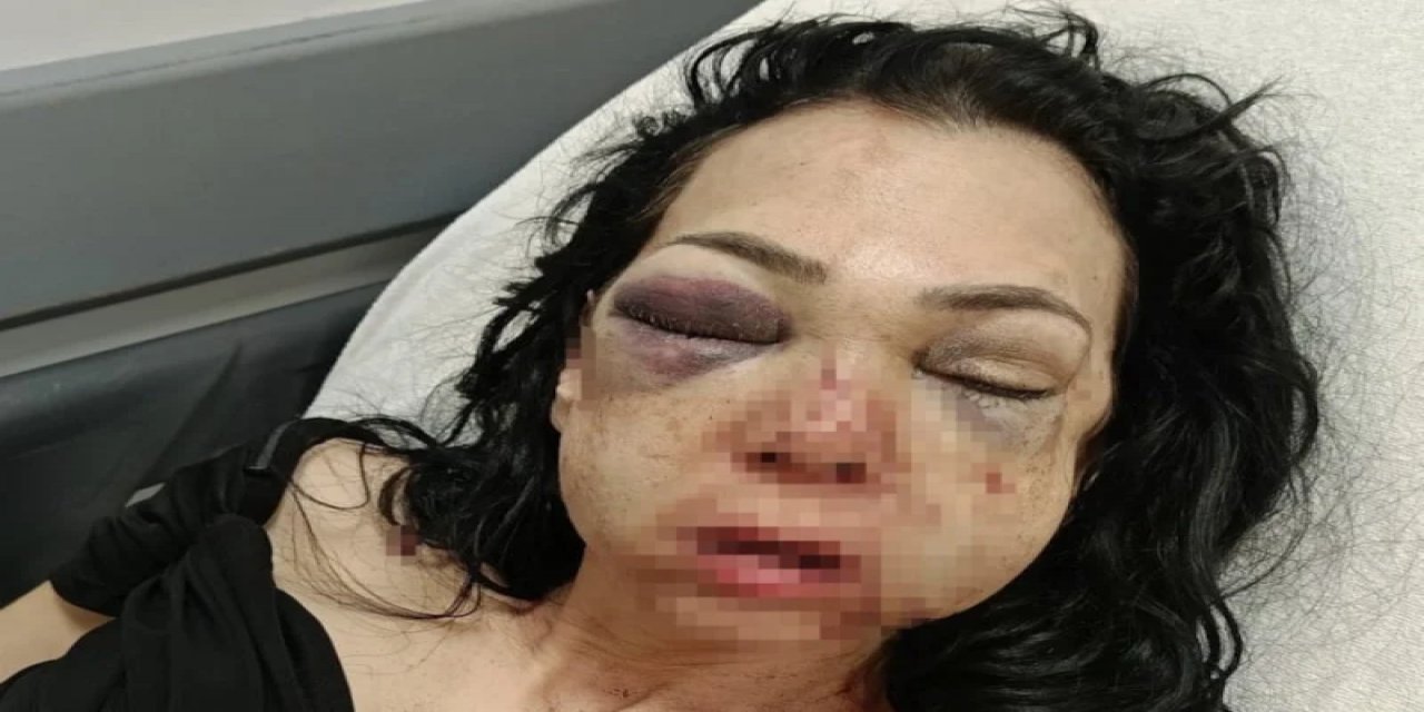 Kocaeli'de Anne Ve Oğlunun Darbedilmesine İlişkin 1 Şüpheli Tutuklandı