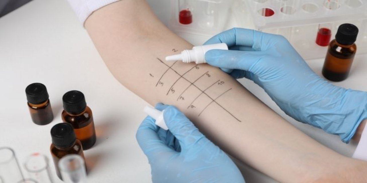 Polen Alerjisi İmmünoterapiyle Kontrol Altına Alınabiliyor