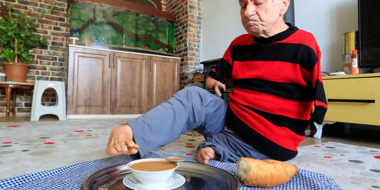 Doğduğu Gün Ölümüne Karar Verilen Mehmet Amca'nın Hayat Hikayesi Ağlattı