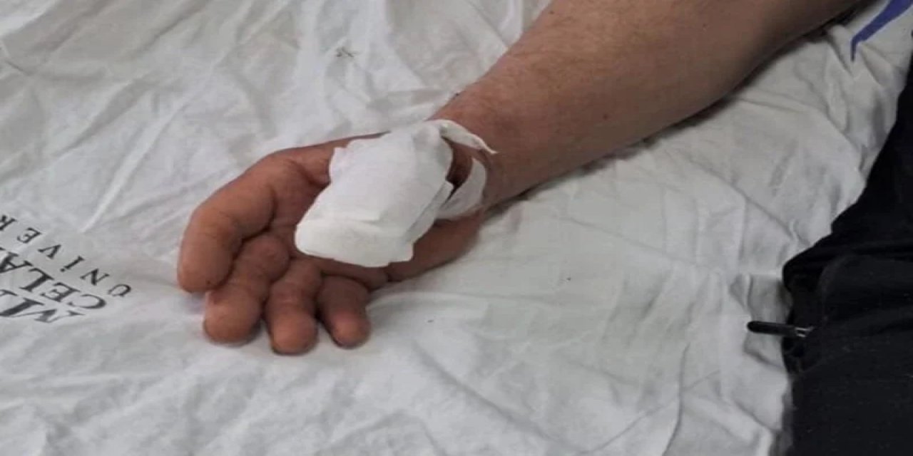 Manisa'da Başıboş Köpek Bir Vatandaşın Parmağını Kopardı