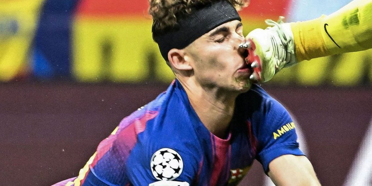 Atletico Madrid-Barcelona Maçında Yürekleri Ağza Getiren Sakatlık