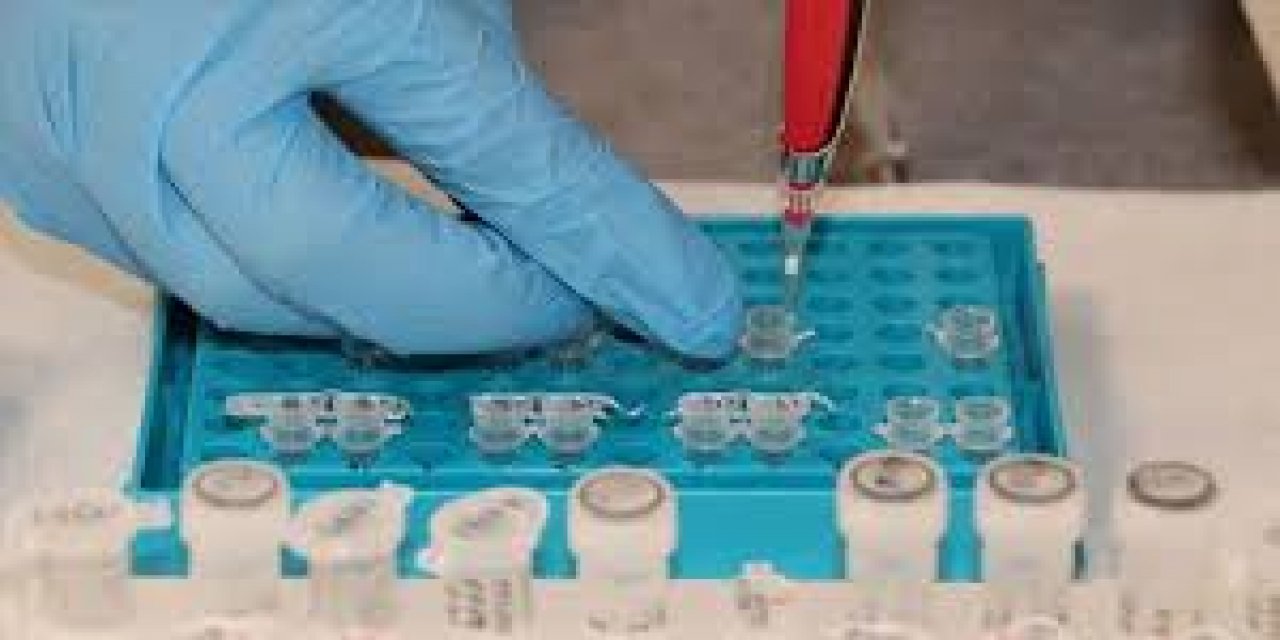 Likit Biyopsi Kanser Takibinde Tedavi Sürecinin İzlenmesine Katkı Sağlıyor