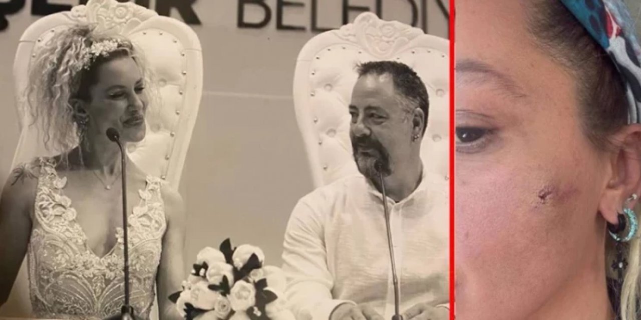 Ünlü Oyuncu Kabusu Yaşadı! Eşi Önce Kendisini Sonra Babasını Darbetti İddiası