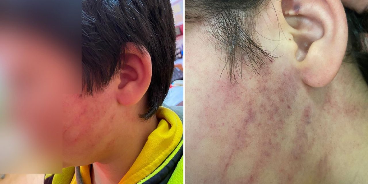 Bu Kadarına Da Pes! Veliler Okulda 8 Yaşındaki Çocukları Dövdü