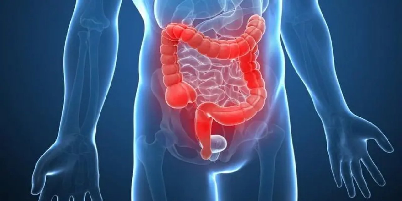 Bağırsak Kanseri Belirtileri Nedir, Dışkı Yoluyla Nasıl Kontrol Edilir?