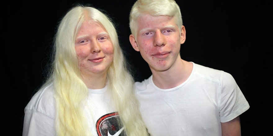 Çukurova'nın Albinoları 4 Mevsim Gölge Arıyor