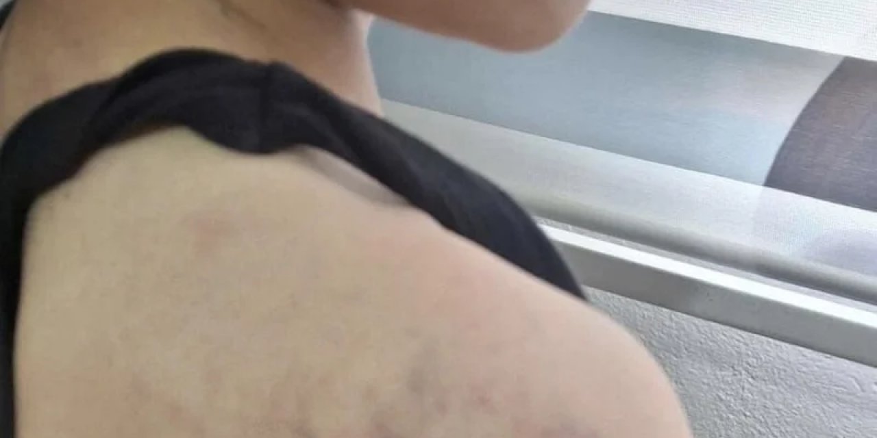 Manisa’da Babasının Darbettiği Çocuk Koruma Altına Alındı