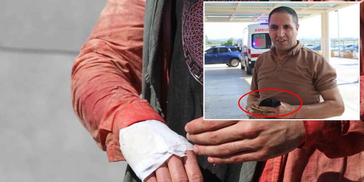 "13 Dakikada Kurbanı Keserim" Diyen Acemi Kasap Kendini Kesti