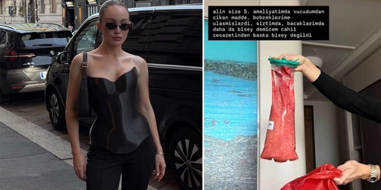 Danla Bilic Yeniden Ameliyat Oldu! Sağlık Durumuyla İlgili Açıklama Geldi