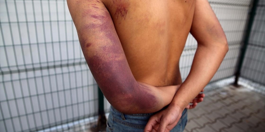 Yunanistan'dan Türkiye'ye Zorla Gönderilen Düzensiz Göçmen: Yunan Askerleri Tüfekle Dövdü