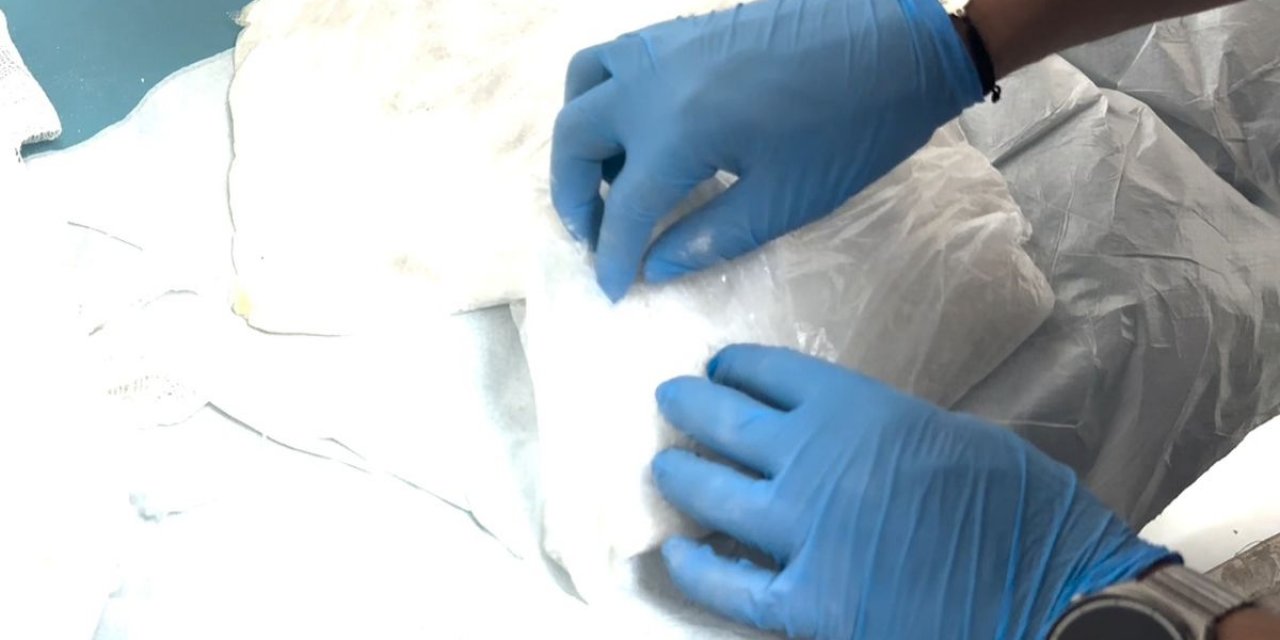 Kolundaki Alçıya 1 Kilo Uyuşturucu Gizleyen Şahıs Tutuklandı