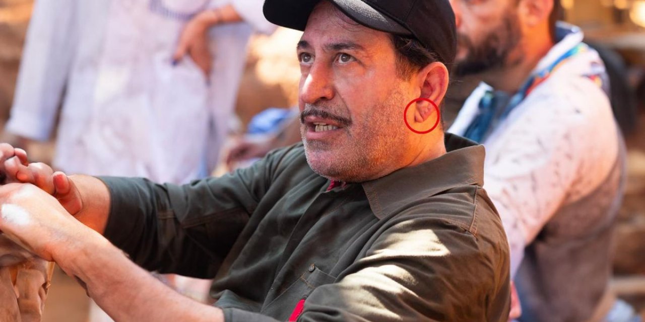 Cem Yılmaz'ın Kalp Krizi Sonrası Herkes Bu Detaya Takıldı