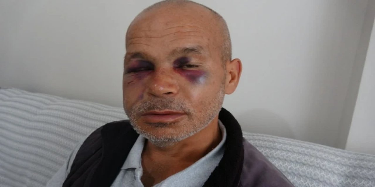 Adana'da Duyma Ve Konuşma Engelli Adam Darbedildi