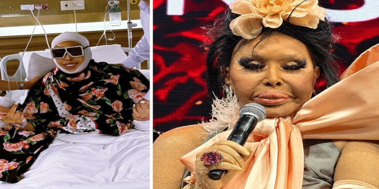 Bülent Ersoy’un Lolita Estetiği Sonrası Son Hali: Bana Abla Demeyin