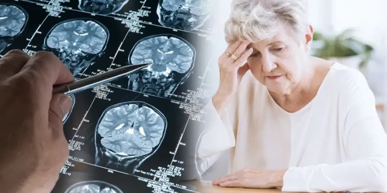 Alzheimer'ın İzleri Unutkanlıktan Yıllar Önce Başlayabiliyor