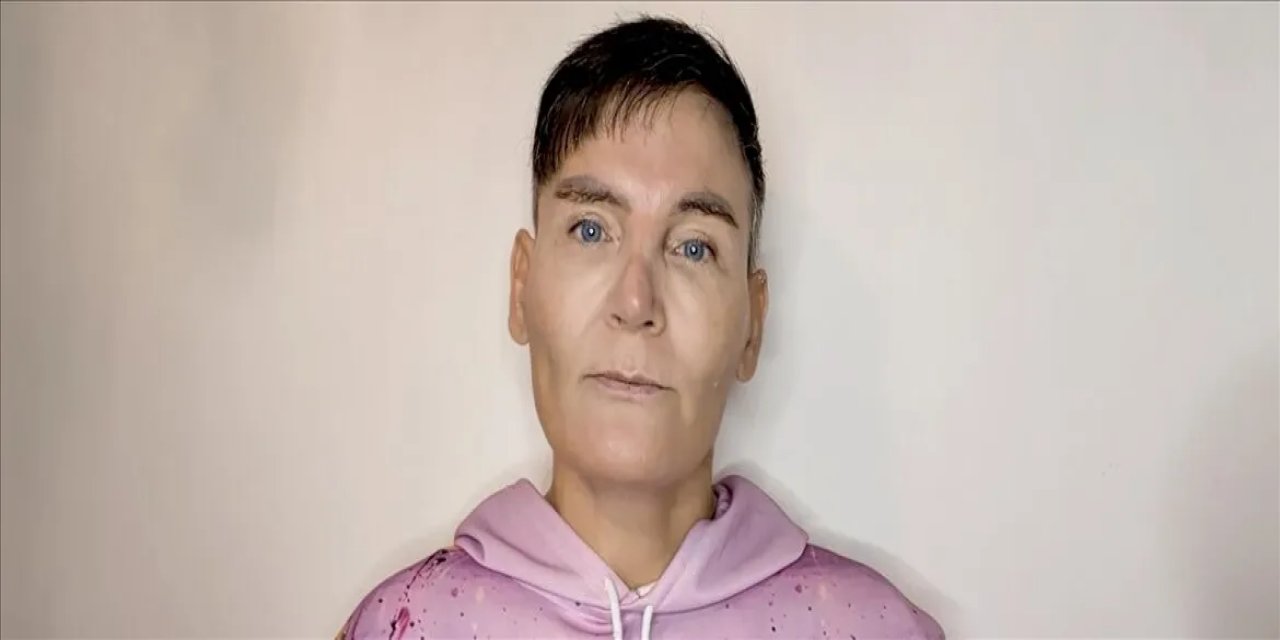 Cinsiyet Değiştirme Kararından Pişman Olan İsviçreli Chris, Yaşadığı Pişmanlığı Aa'ya Anlattı