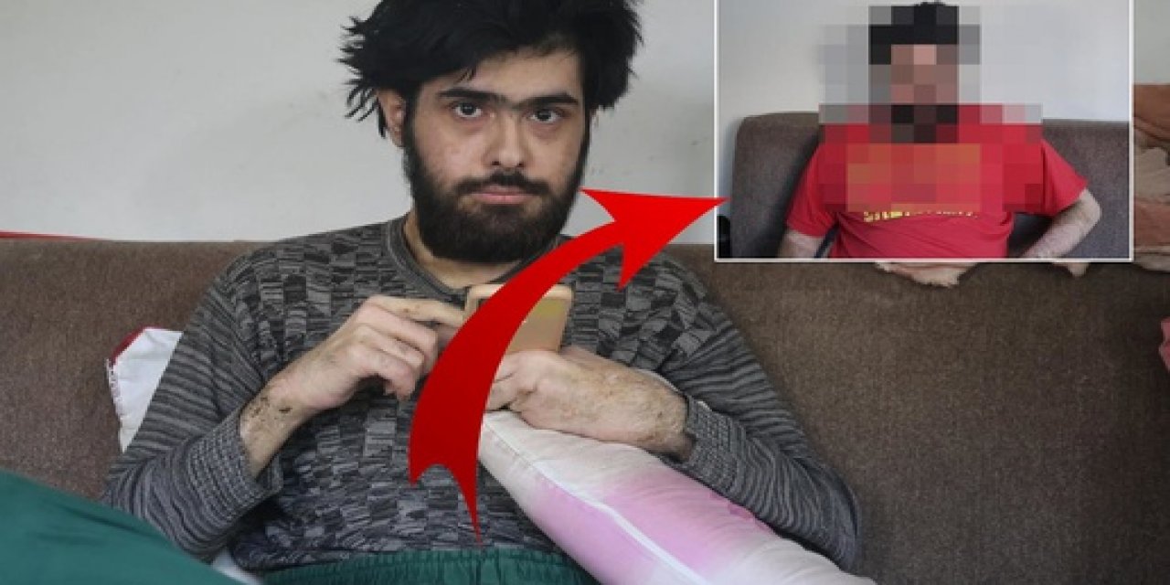 Hatay'da Tedaviyi Reddeden Telefon Bağımlısı Barış, Eski Yaşamına Geri Döndü