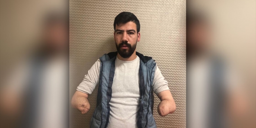 Yeni Kollarıyla Araba Kullanmanın Hayalini Kuruyor