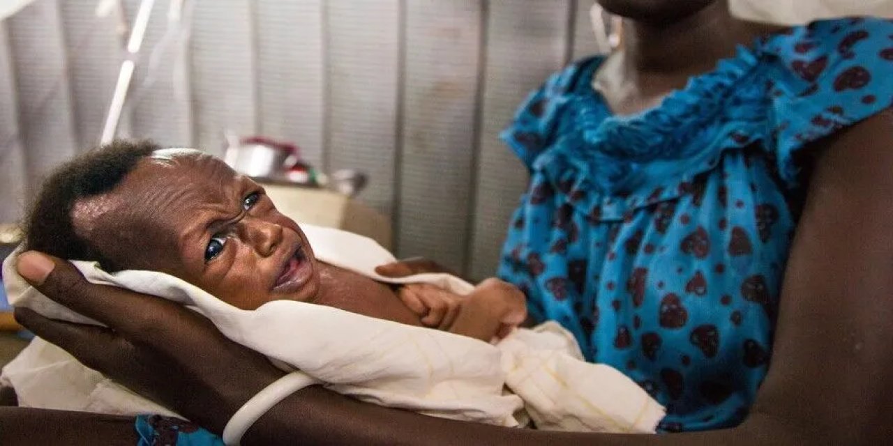 DSÖ: Sudan'da Yetersiz Beslenen Çocuklar Ölümcül Hastalıklara Karşı Daha Savunmasız