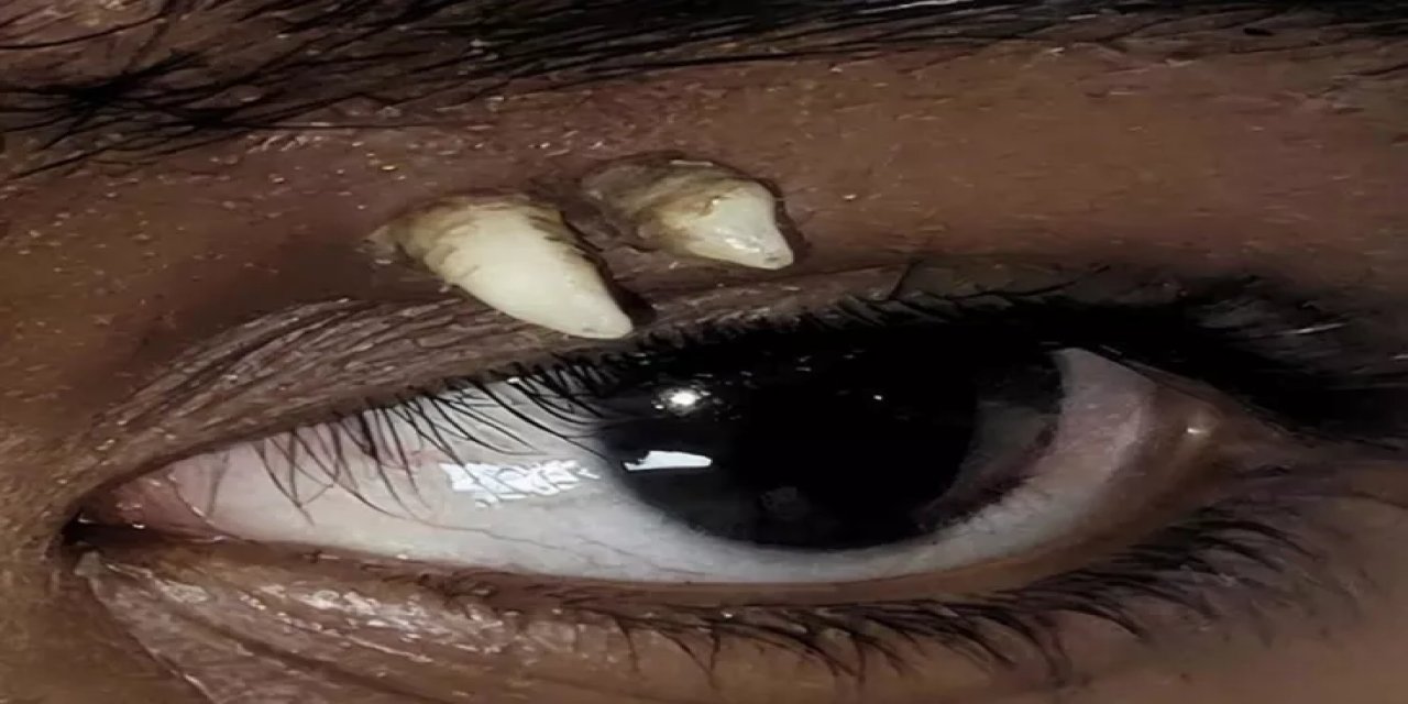 Tıp Tarihinde Bir İlk! Muayene Eden Doktorlar Bile İnanamadı