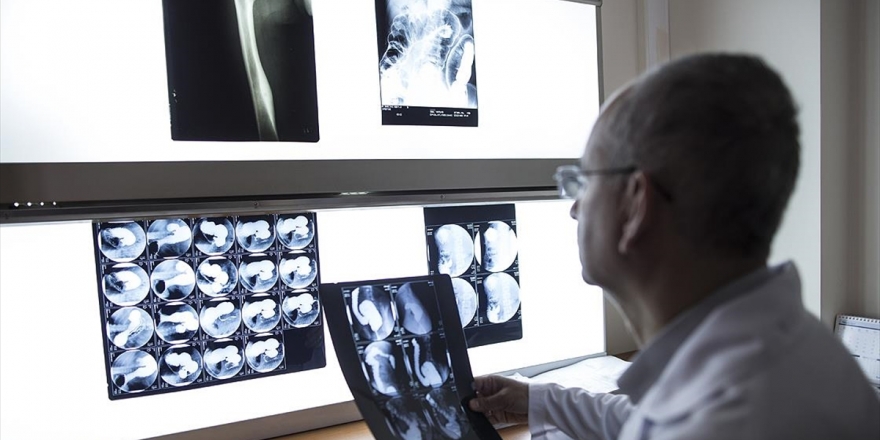 Sağlık Hizmeti Alan Yabancılara 20 Ülkedeki Tanı Merkezlerinden 'Tedavi Sonrası Takip'