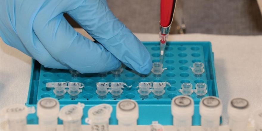 Adana'dan Yurt Dışına Kanser Testi Hizmeti