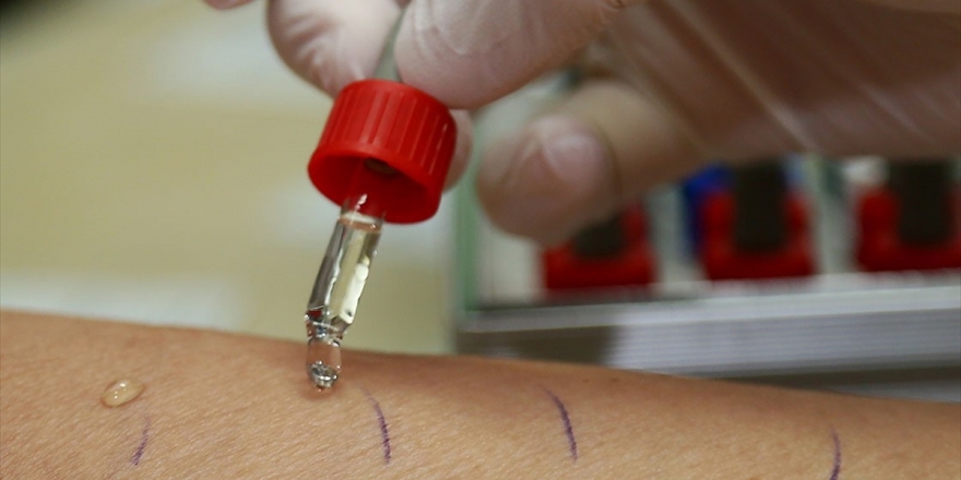 Kış Mevsiminde Alerjik Hastalık Bulguları Artıyor