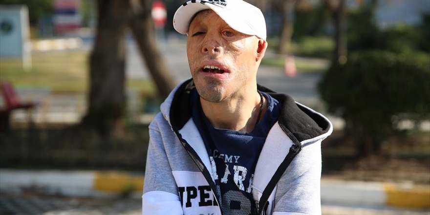 Mehmet Ali De 'Yüzünün' Gülmesini İstiyor