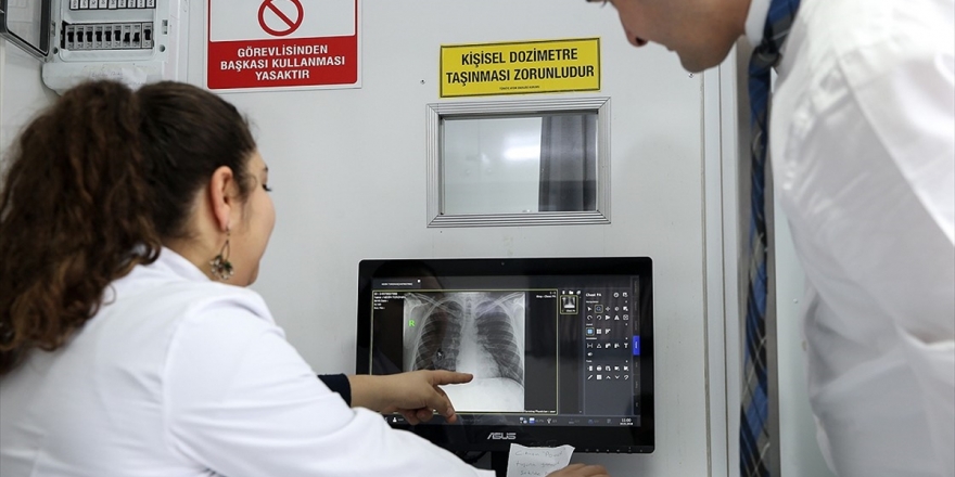 Türkiye'de Tüberküloz Ölüm Hızı Dünya Ortalamasının Altında