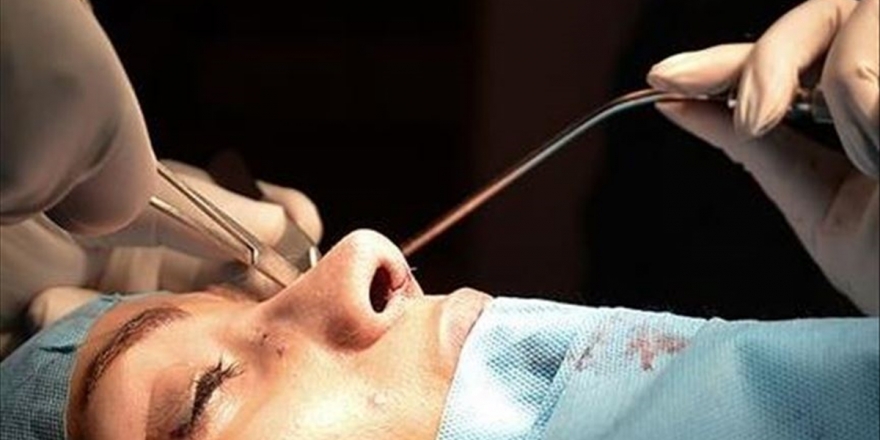 Sömestirde Erkekler Saç Ekimi, Kadınlar Estetik Yaptıracak