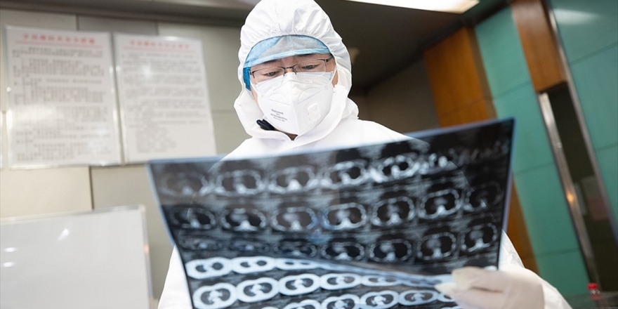 Çin’de Yeni Tip Koronavirüs Nedeniyle Ölenlerin Sayısı 637’ye Çıktı