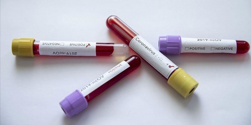 Çinli Araştırmacılar Kovid-19 Salgınının Pazar Dışında Bir Yerde Başladığı Kanısında