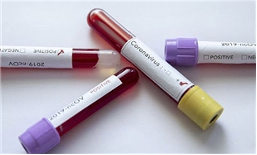 KERİME YILDIZ YAZDI: KORKU, BAĞIŞIKLIĞI BOZAR