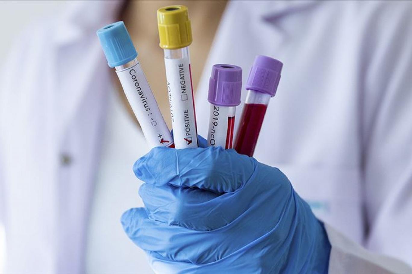 NURAY BAŞARAN YAZDI: VİRÜS SAVAŞLARI - SEFERBERLİK!