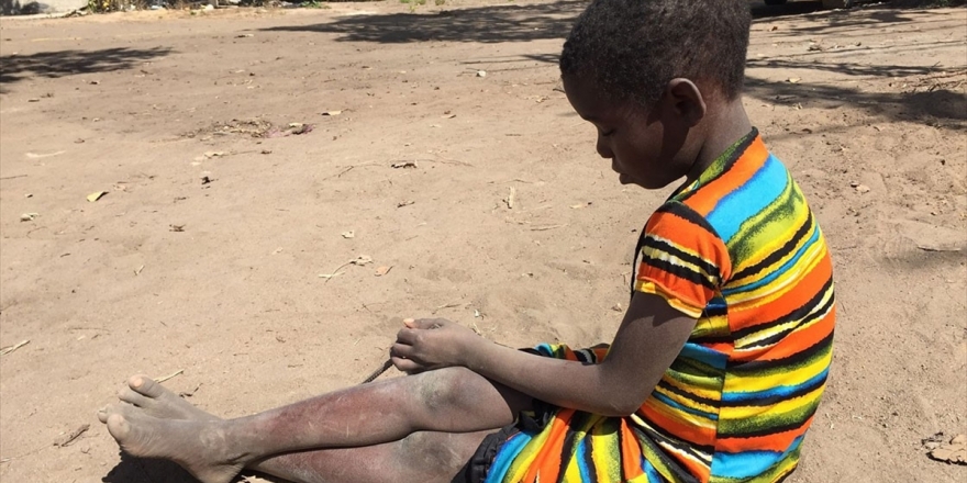 İsraf Edilen 1,3 Milyar Ton Gıda 821 Milyon Aç İnsanı Doyurabilir