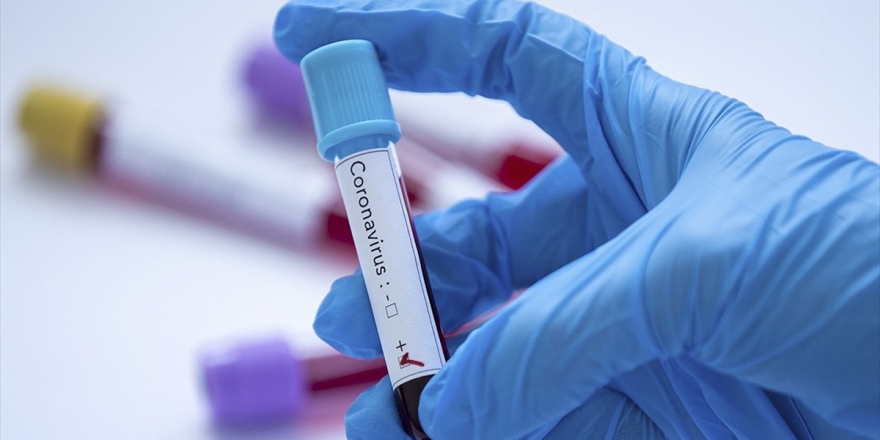 ABD'de Koronavirüsten Ölenlerin Sayısı 6'ya Yükseldi