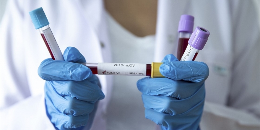 Cezayir'de Yeni Tip Koronavirüs Kaynaklı İlk Ölüm