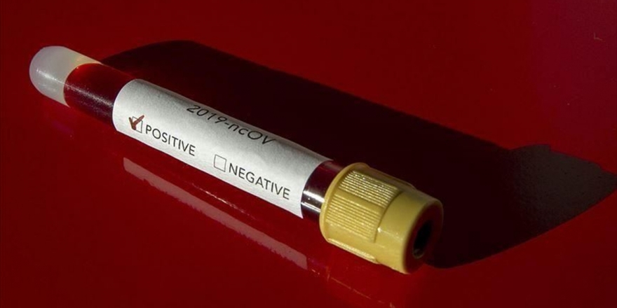 ABD'de NBA Oyuncularının Koronavirüs Testine Hızlı Erişimi Tepkilere Neden Oldu