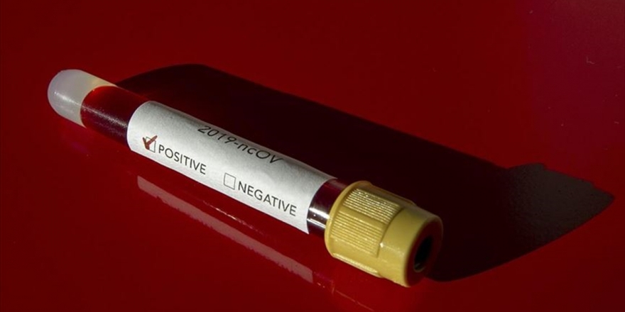 Koronavirüs Testi Yaptıranlar Sonuçlara 'Enabız'dan Ulaşabilecek