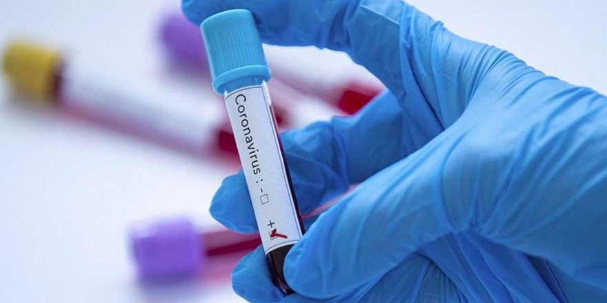 Kovid-19 Önlemlerinde Son Durum