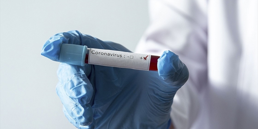 İran'da 35 Günlük Bebekte Kovid-19 Tespit Edildi