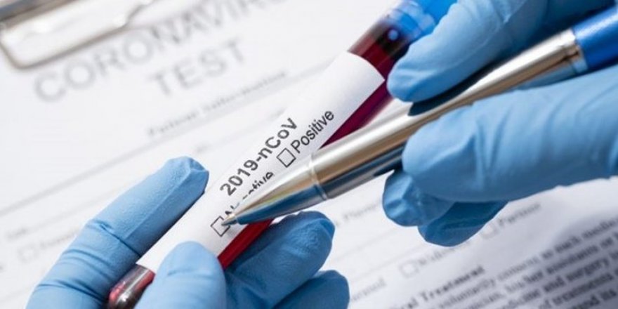 İtalya'dan Koronavirüs Vakalarıyla İlgili Flaş Açıklama