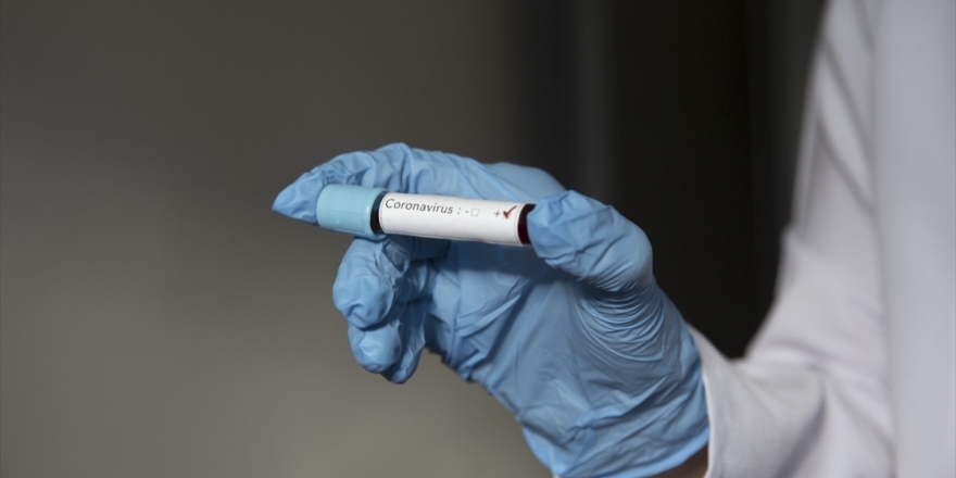 Esed Rejimi, Suriye'de Kovid-19 Kaynaklı İlk Ölümün Yaşandığını Açıkladı