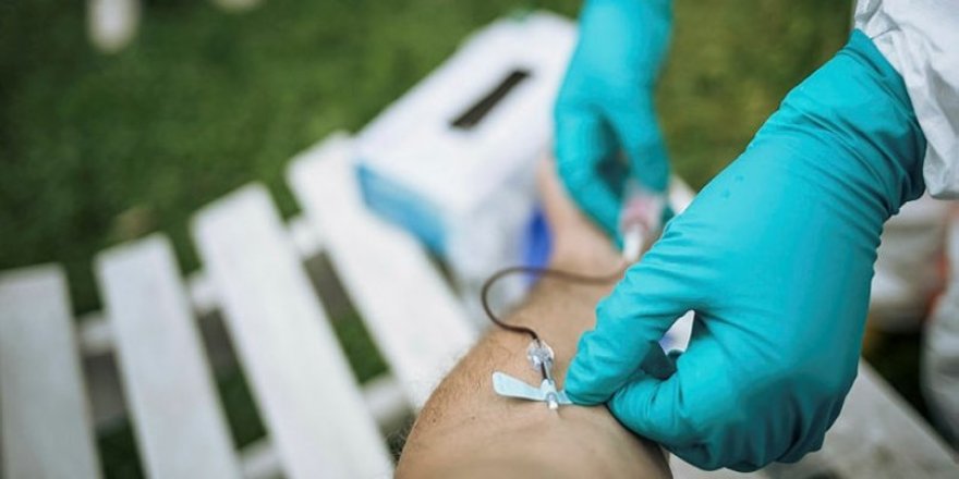 ABD'de Koronavirüsten Son 24 Saatte 657 Kişi Öldü