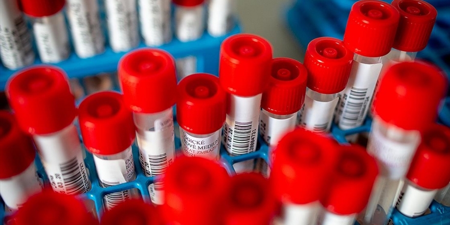 Sağlık Bakanlığı Referans Laboratuvarı'nda Kovid-19 Virüsü İzole Edildi