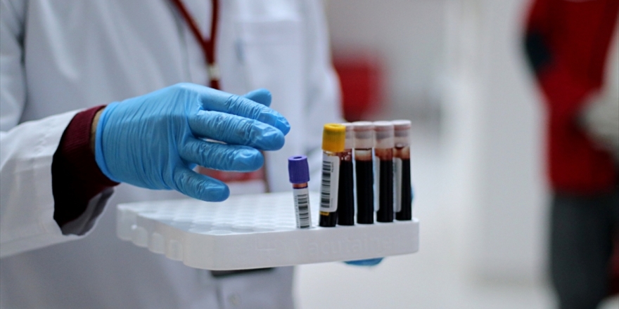 Dokuz Eylül Üniversitesinde 'İmmun Plazma' Tedavisi Başladı