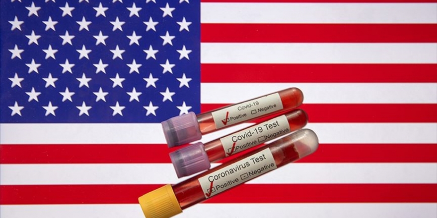 ABD'de Kovid-19 Nedeniyle Ölenlerin Sayısı 30 Bini Geçti